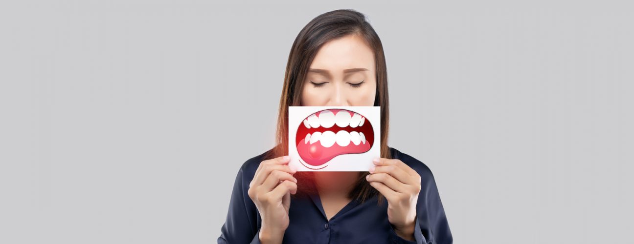 Understanding the Stages of Gum Disease from Gingivitis to Periodontitis