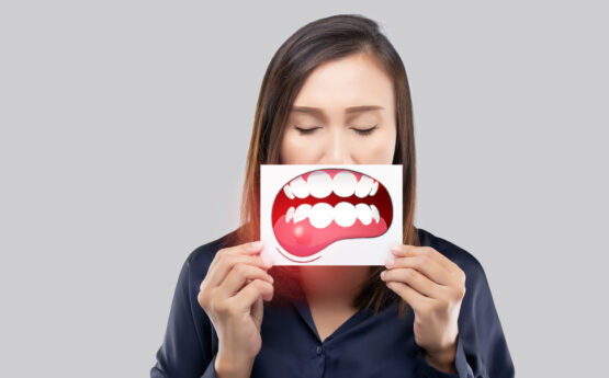 Understanding the Stages of Gum Disease from Gingivitis to Periodontitis