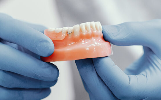 Why Dental Bridges Are Good for Your Smile