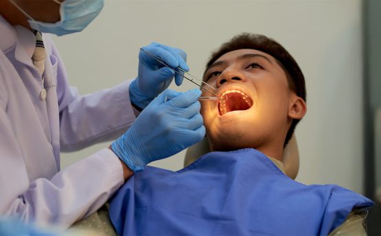 How Do I Know if One of My Teeth Needs a Root Canal Rather Than a Simple Filling?
